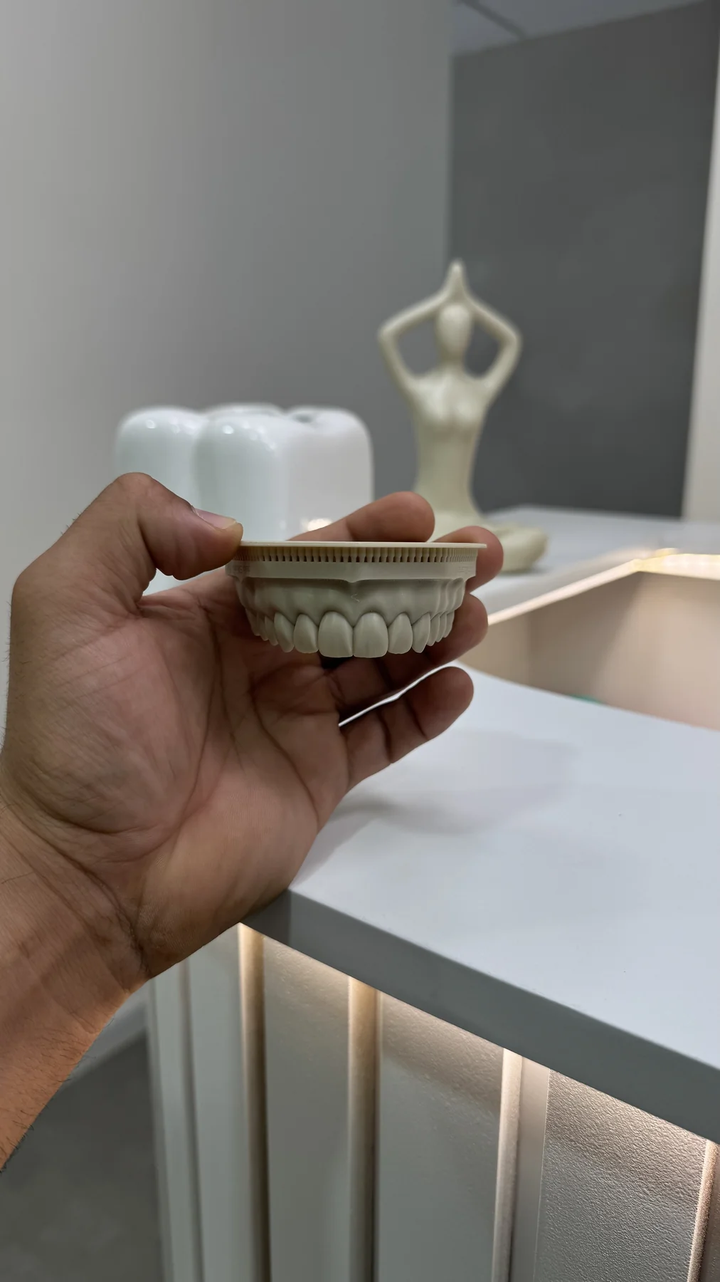 Dental model in hand at Aura Dental Spa, Tijuana